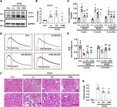 Corrigendum: Persistent activation of autophagy after cisplatin nephrotoxicity promotes renal fibrosis and chronic kidney disease